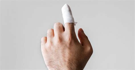 Mallet Finger Symptoms Causes Treatments Optimists Healthcare