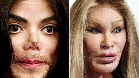 top 5 celebrity plastic surgery disasters youtube