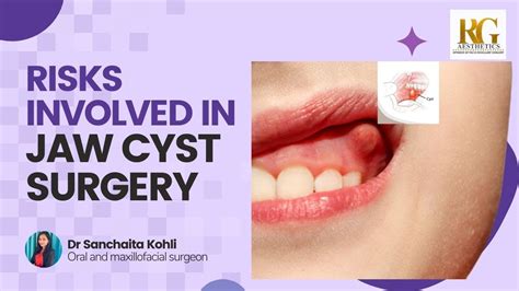 Risks Involved In Jaw Cyst Surgery Face Surgery In Delhi Dr