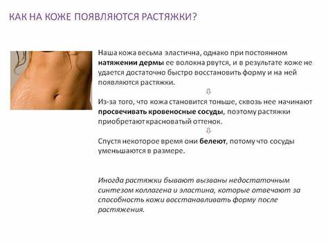 Убрать растяжки дома на животе