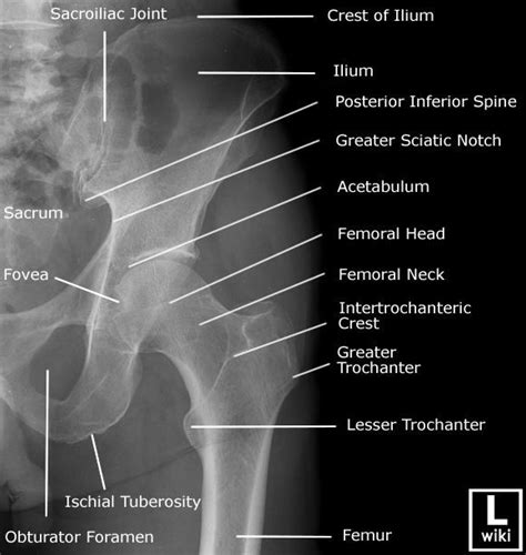 Radiographic Anatomy Hip Ap Radiology Student Anatomy Radiology