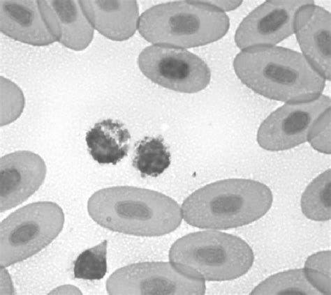 Two Basophils Center And One Lymphocyte In A Peripheral Blood Smear