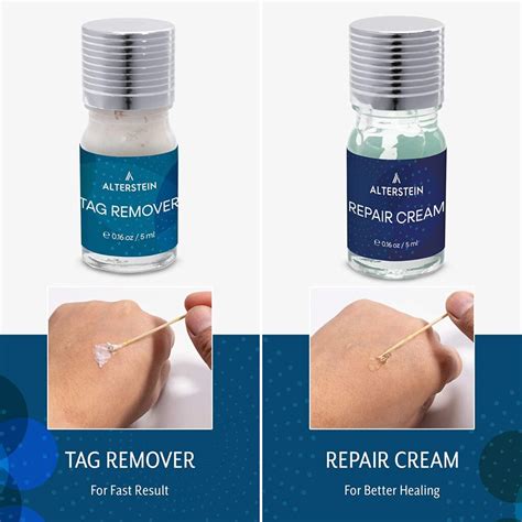 Skin Tag Remover Skin Tag Wart And Mole Remover Set Treat Your Skin