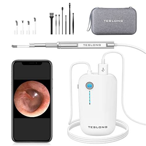 10 Best Digital Otoscope For Phone Recommended By An Expert In 2022