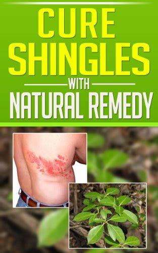 Cure Shingles With Natural Remedy Ebook Alina Max Kindle