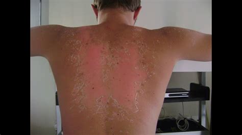 Préparer Sa Peau Au Soleil Prepare Your Skin For The Summer Sun