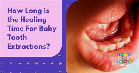 How Long Is The Healing Time For Baby Tooth Extractions Junior