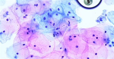 Microscope World Blog Pap Smear Under The Microscope