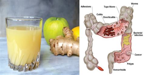 Release Pounds Of Toxins From Your Body With This 3 Ingredient Apple