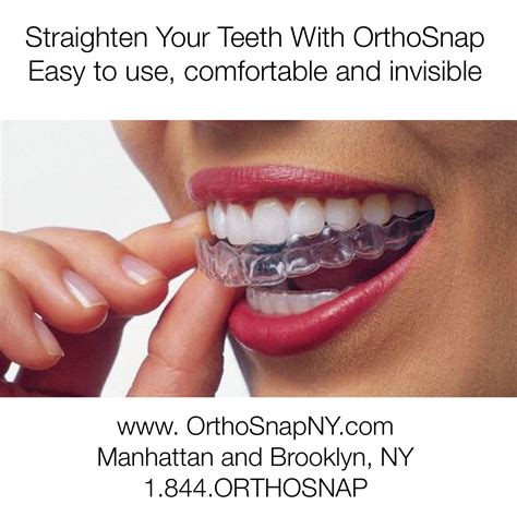 Braces are not the only way to achieve a straighter smile. Straighten Teeth Without Braces | Implant, Beautiful