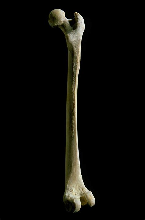 Human Femur Or Thigh Bone Photograph By James Stevensonscience Photo