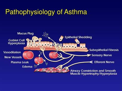 Ppt Asthma Pathophysiology Asthma Overview Powerpoint Presentation