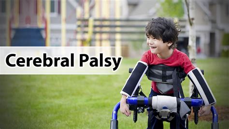 Cerebral Palsy Causes Symptoms Life Expectancy Types Treatment