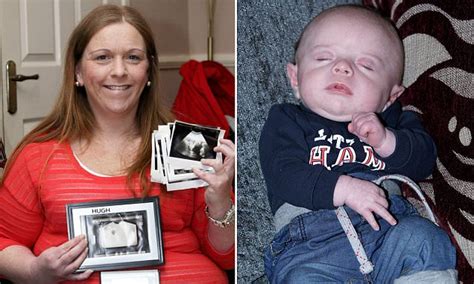 Woman Born With Two Wombs And Two Vaginas Gives Birth To A