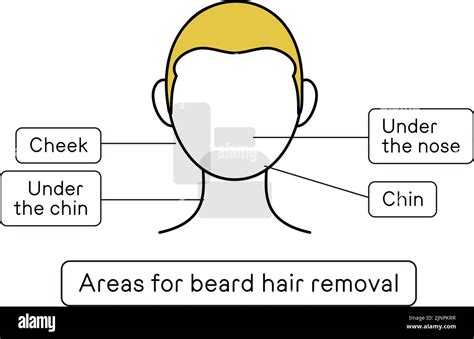 Illustration Of Hair Removal Areas For Beard Hair Removal Stock Vector