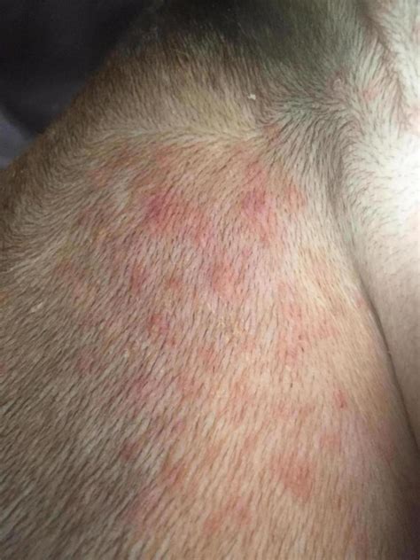Bumps Heat Rash On Dogs Belly What Should I Do About A Rash On My