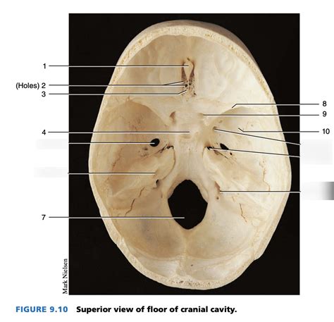 Bone Features On Superior Skull Floor Of Cranial Cavity Diagram Quizlet