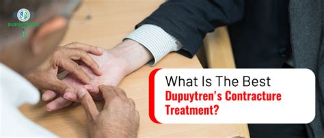 Which Is The Best Treatment For Dupuytrens Contracture