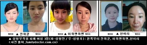 “한국서 성형수술 인생 망쳤다” 중국 ‘시끌 코메디닷컴