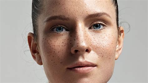 What Your Freckles Are Telling You About Your Skin Shefinds