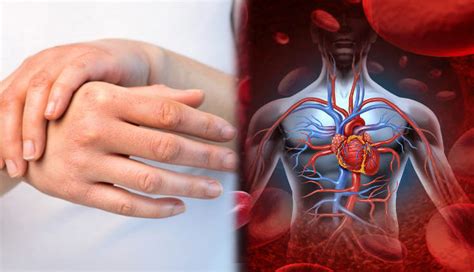 5 Signs That Tell You Have Poor Blood Circulation