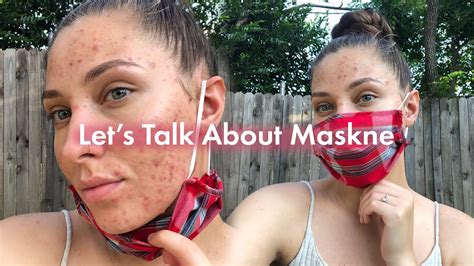6 Ways To Get Rid Of Maskne Mask Acne Hero Cosmetics Youtube