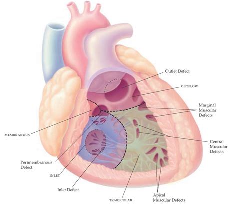 Congenital Heart Disease Part 2
