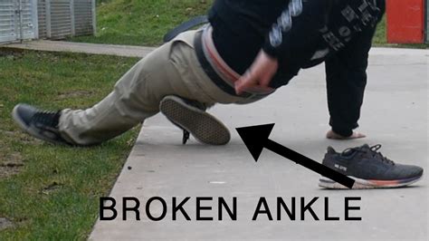 Watch Me Break My Ankle Youtube
