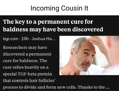Incoming Cousin It The Key To A Permanent Cure For Baldness May Have