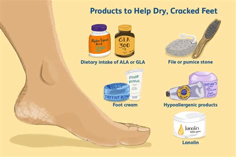 A callus can appear even if there is little to no rubbing. How to Cope With Dry Skin and Cracks on Your Feet The ...