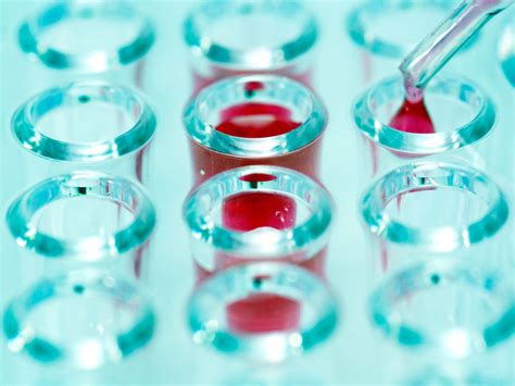 Infectious mononucleosis (mono) is often called the kissing disease. Peritonsillar Abscess: Causes, Symptoms, and Treatment