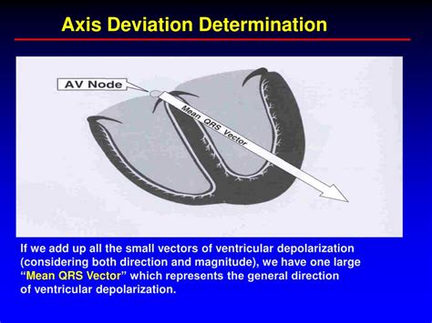 Ppt Electrophysiology Axis Deviation Powerpoint Presentation Free