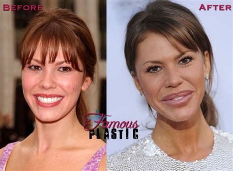 Has Nikki Cox Had Plastic Surgery Before And After Lip Implants And