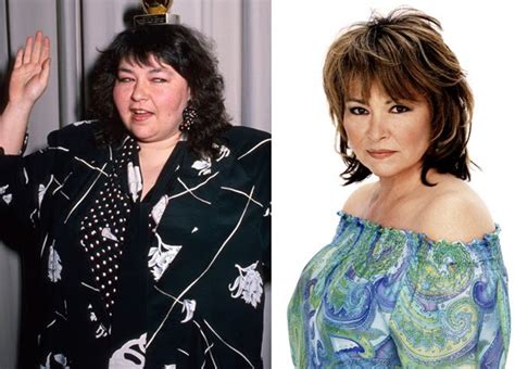 Roseanne Barr Before And After Plastic Surgery