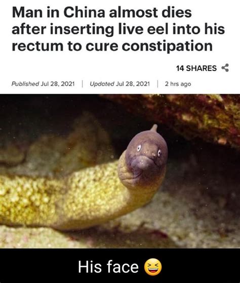 Man In China Almost Dies After Inserting Live Eel Into His Rectum To