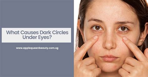 The Main Causes Of Dark Circles Under The Eyes