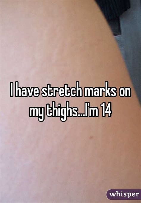 I Have Stretch Marks On My Thighsim 14