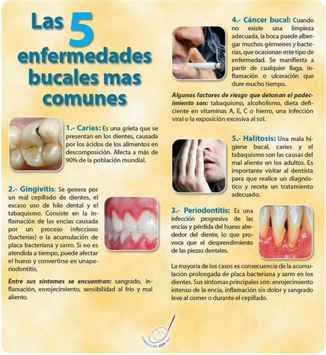 Las 5 Enfermedades Bucales Más Comunes Dentist Enfermedades