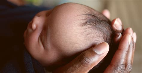 Newborn Held In Hands Featured Kaleidoscope Fighting Lupus