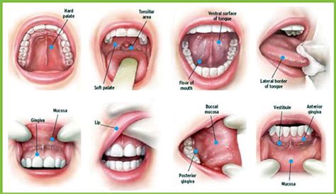 Oral Cancer Diagnosis