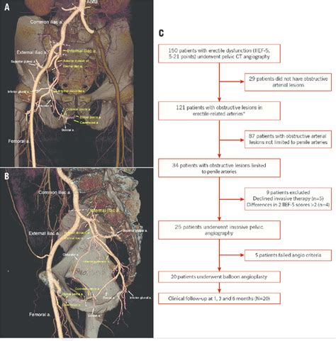 Pelvic Ct Angiography Showing The Anatomy And Nomenclature Of The Whole