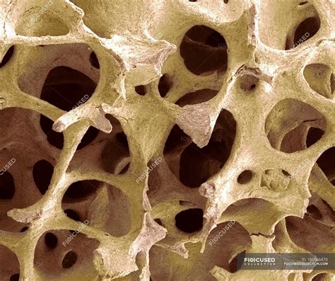 Cancellous Bone Tissue — Scanning Electron Microscope Normal Stock