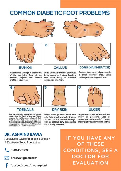 Feet Problems From Diabetes Effective Health