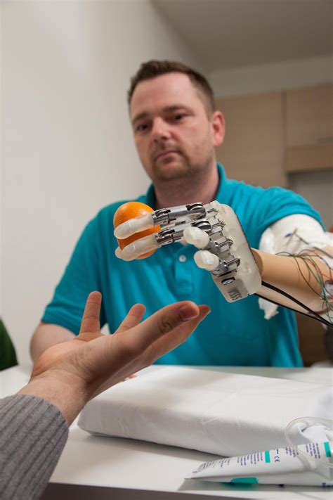 Amputee Feels In Real Time With Bionic Hand Epfl