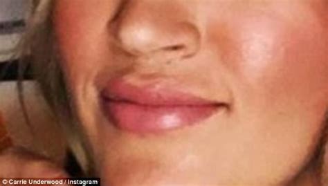 Carrie Underwood Offers Up Glimpse Of Lip Scar In Sporty Instagram Post