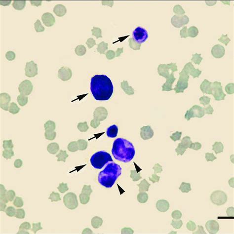 Pdf Acute Erythroid Leukemia With Multilineage Dysplasia In A Cat