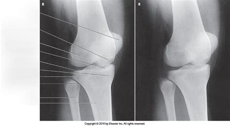 Figure 06 133 Ap Oblique Knee Medial Rotation Diagram Quizlet