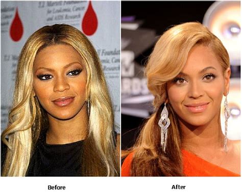 Beyonce Nose Job Before And After Photo Beyonce Nose Job Before And