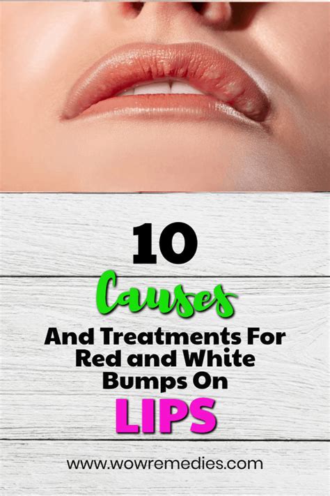 White Or Red Spotsbumps On Lips Causes And Treatments Lips Red