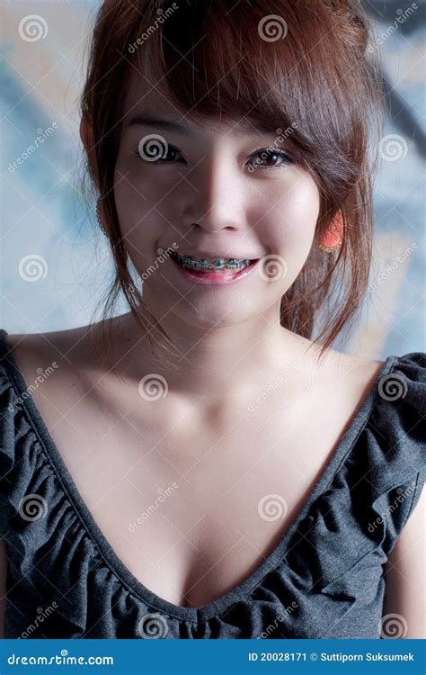 Braces Asian Girl Portrait Stock Image Image Free Download Nude Photo Gallery